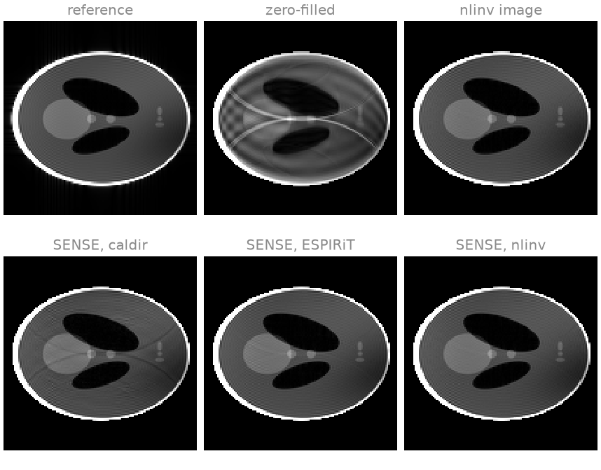 reference, zero-filled, nlinv image, SENSE, caldir, SENSE, ESPIRiT, SENSE, nlinv