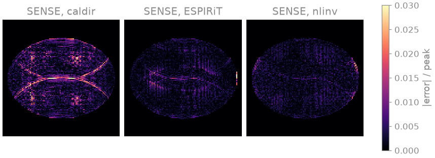 SENSE, caldir, SENSE, ESPIRiT, SENSE, nlinv
