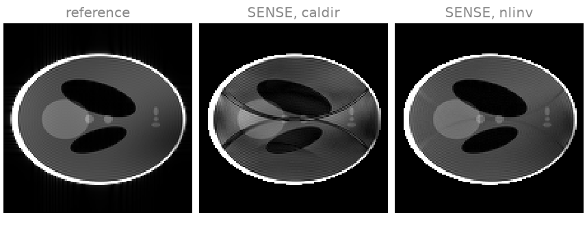 reference, SENSE, caldir, SENSE, nlinv