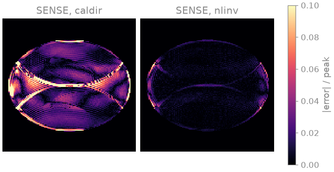 SENSE, caldir, SENSE, nlinv
