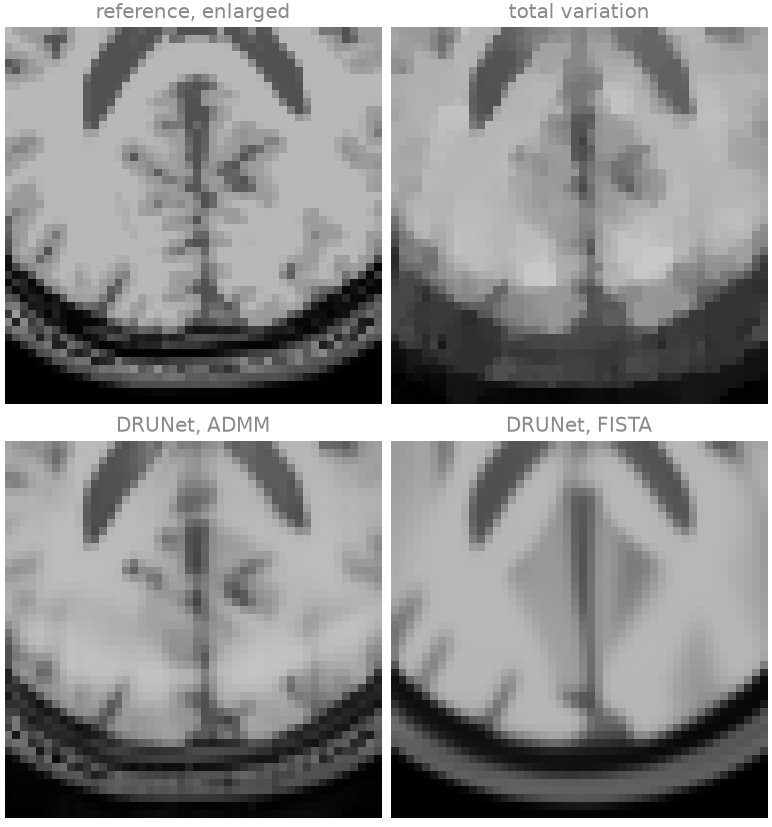 reference, enlarged, total variation, DRUNet, ADMM, DRUNet, FISTA