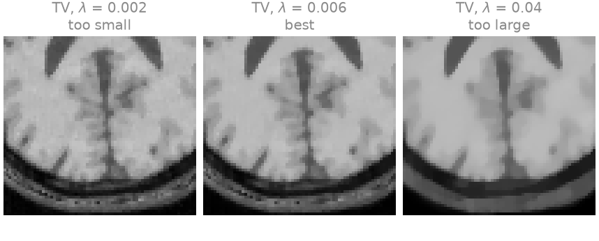TV, $\lambda$ = 0.002 too small, TV, $\lambda$ = 0.006 best, TV, $\lambda$ = 0.04 too large
