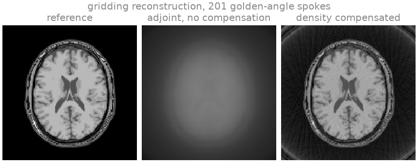 gridding reconstruction, 201 golden-angle spokes, reference, adjoint, no compensation, density compensated