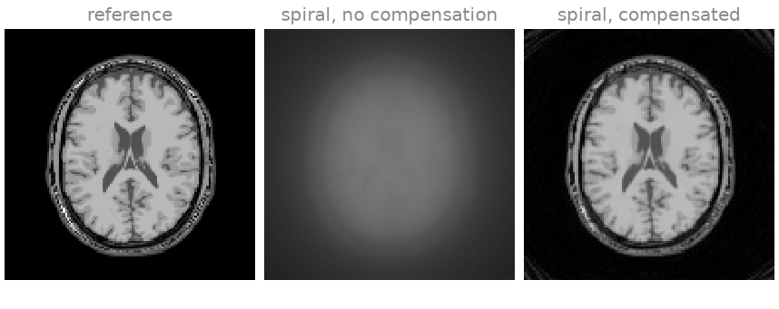 reference, spiral, no compensation, spiral, compensated