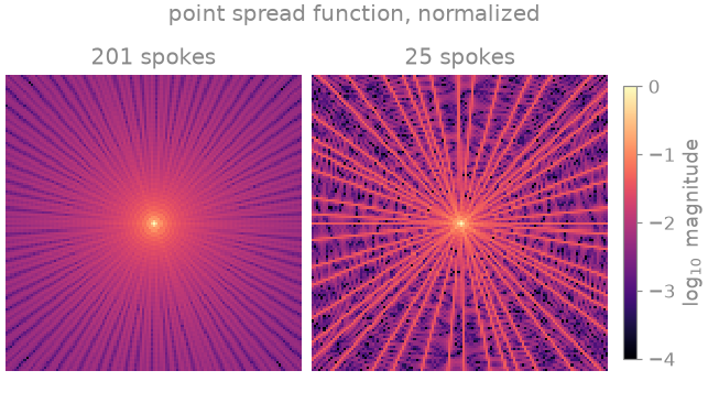point spread function, normalized, 201 spokes, 25 spokes
