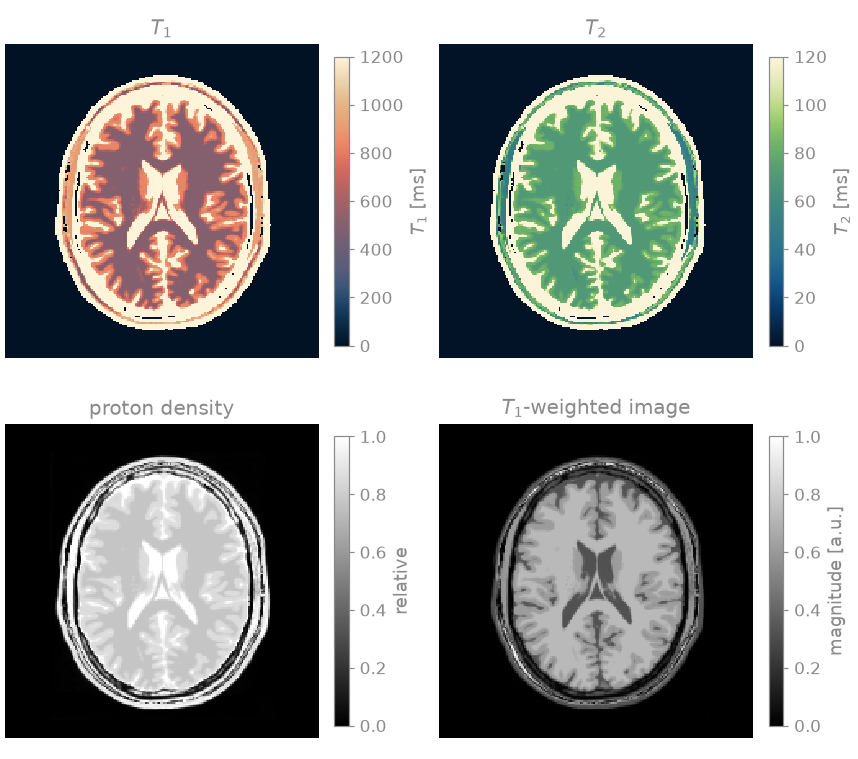 $T_1$, $T_2$, proton density, $T_1$-weighted image