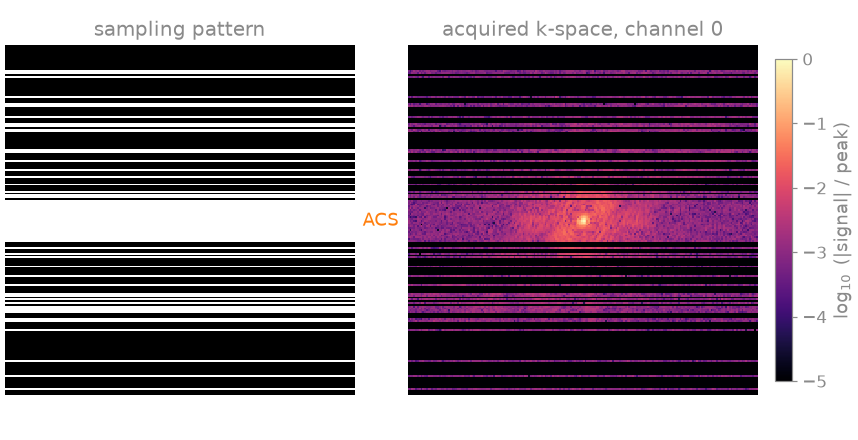 sampling pattern, acquired k-space, channel 0