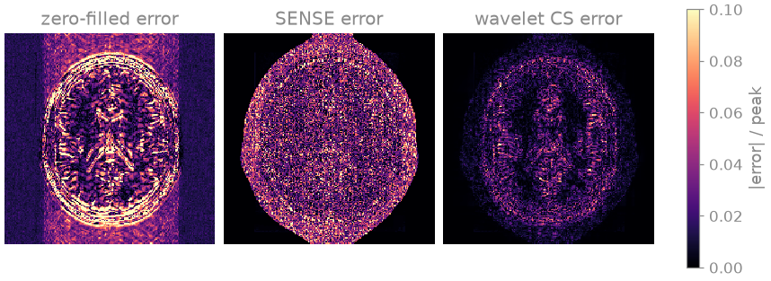 zero-filled error, SENSE error, wavelet CS error