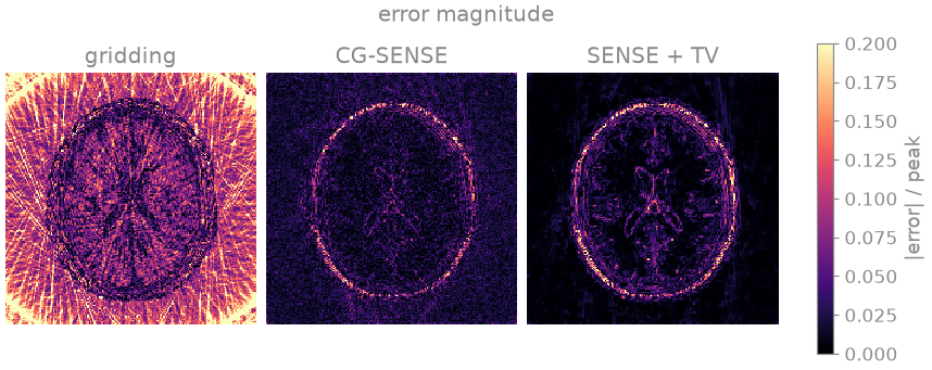 error magnitude, gridding, CG-SENSE, SENSE + TV