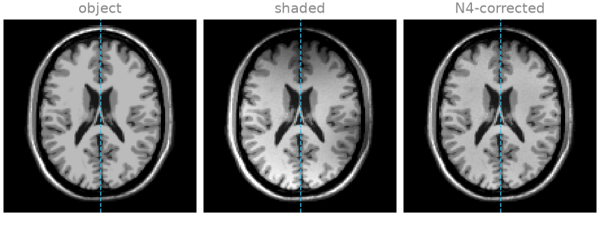 object, shaded, N4-corrected