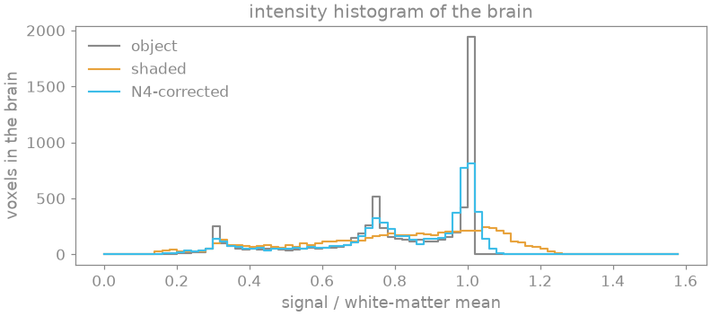 intensity histogram of the brain