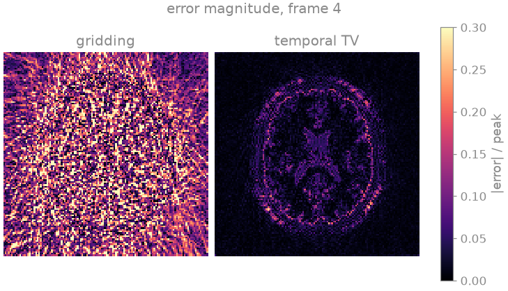 error magnitude, frame 4, gridding, temporal TV