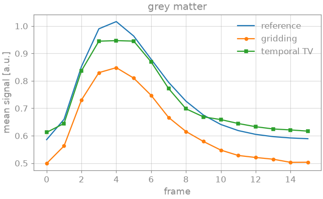grey matter