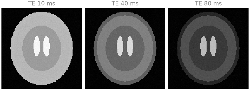 TE 10 ms, TE 40 ms, TE 80 ms