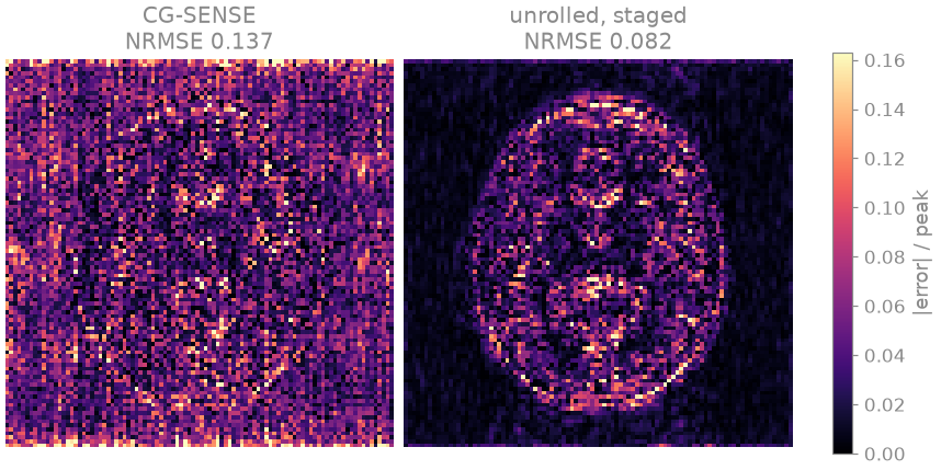CG-SENSE NRMSE 0.137, unrolled, staged NRMSE 0.082