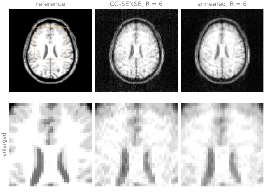 reference, CG-SENSE, R = 6, annealed, R = 6