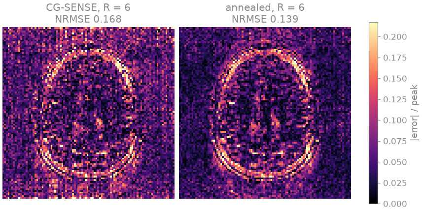 CG-SENSE, R = 6 NRMSE 0.168, annealed, R = 6 NRMSE 0.139