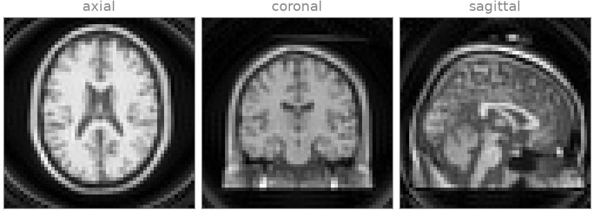 axial, coronal, sagittal