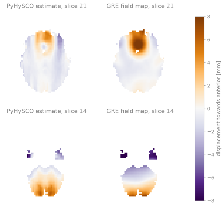PyHySCO estimate, slice 21, GRE field map, slice 21, PyHySCO estimate, slice 14, GRE field map, slice 14