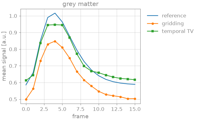 grey matter