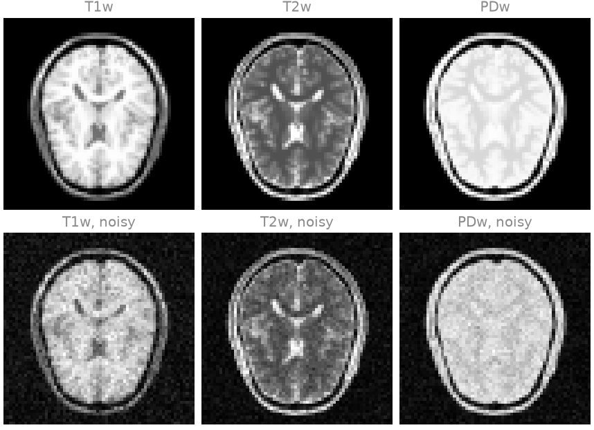 T1w, T2w, PDw, T1w, noisy, T2w, noisy, PDw, noisy
