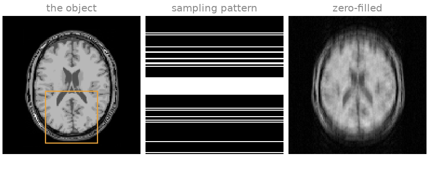 the object, sampling pattern, zero-filled