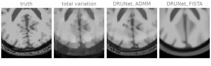 truth, total variation, DRUNet, ADMM, DRUNet, FISTA