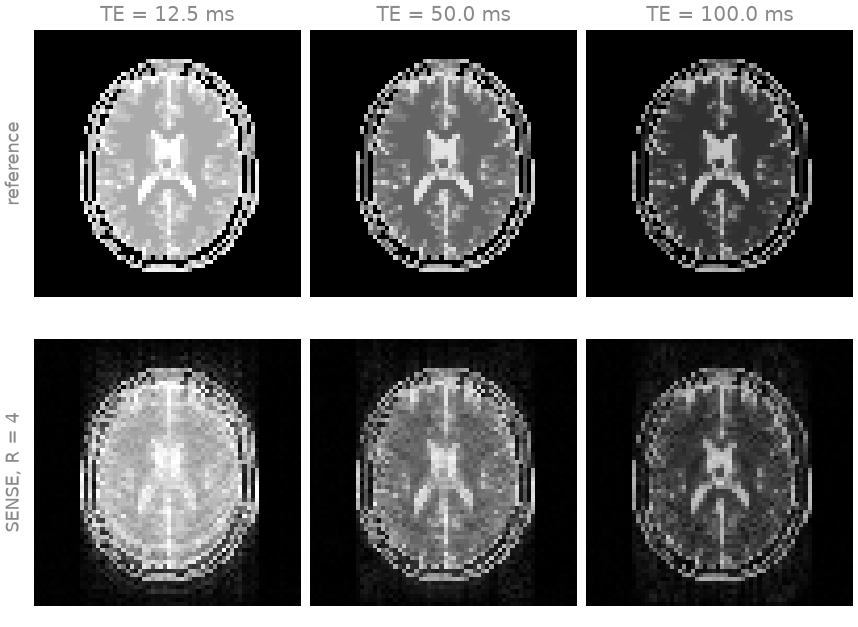 TE = 12.5 ms, TE = 50.0 ms, TE = 100.0 ms