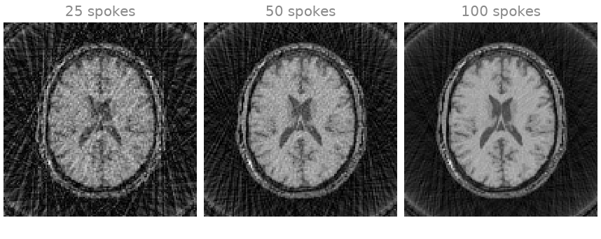 25 spokes, 50 spokes, 100 spokes