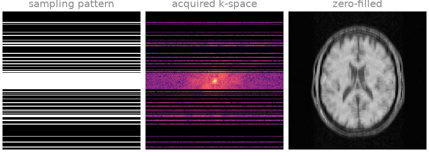 sampling pattern, acquired k-space, zero-filled