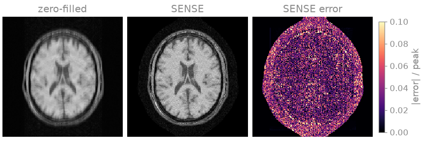 zero-filled, SENSE, SENSE error