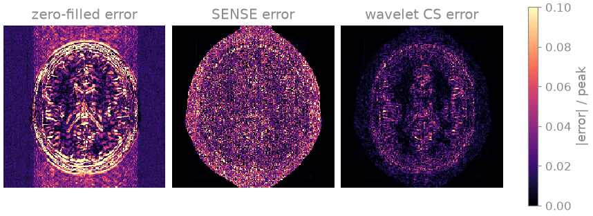 zero-filled error, SENSE error, wavelet CS error