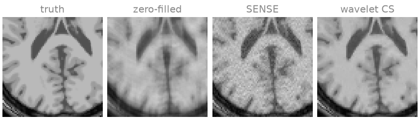 truth, zero-filled, SENSE, wavelet CS