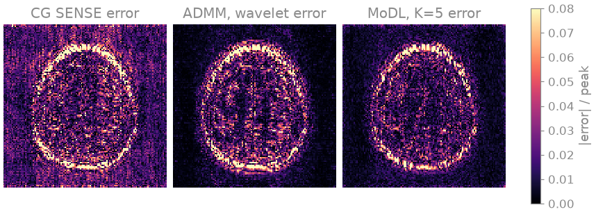 CG SENSE error, ADMM, wavelet error, MoDL, K=5 error