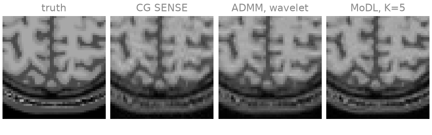 truth, CG SENSE, ADMM, wavelet, MoDL, K=5
