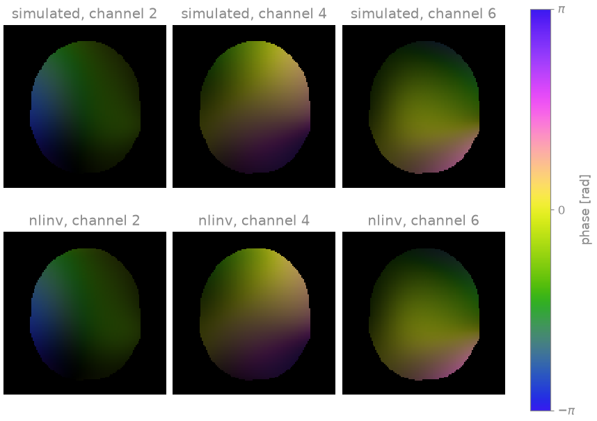 simulated, channel 2, simulated, channel 4, simulated, channel 6, nlinv, channel 2, nlinv, channel 4, nlinv, channel 6