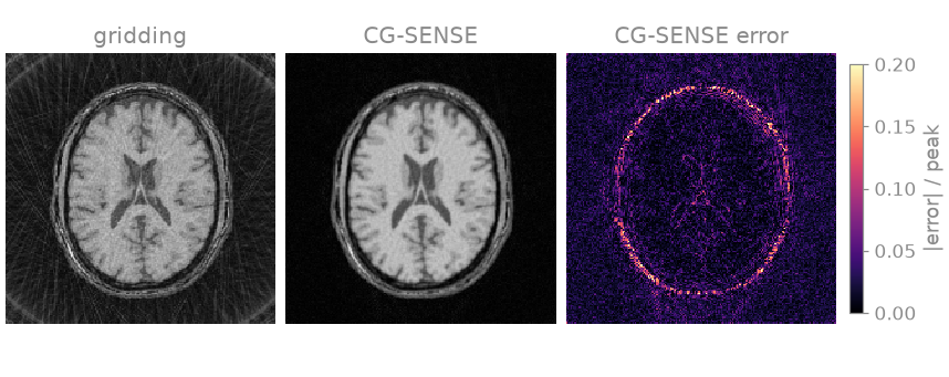 gridding, CG-SENSE, CG-SENSE error