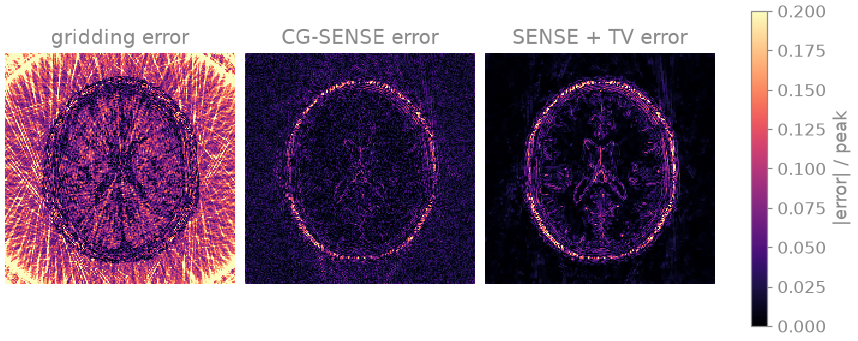 gridding error, CG-SENSE error, SENSE + TV error