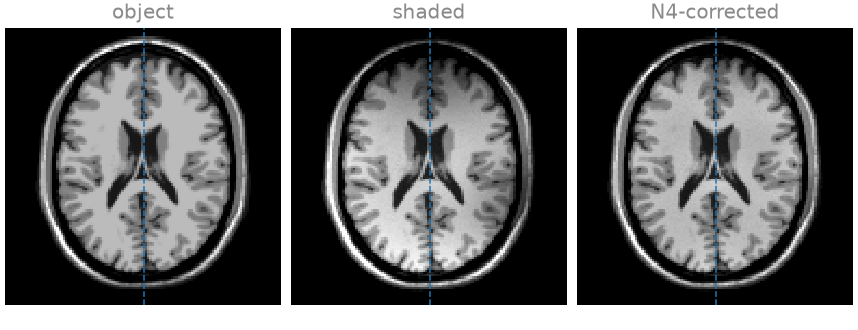 object, shaded, N4-corrected