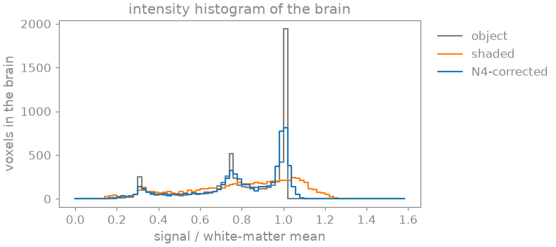 intensity histogram of the brain