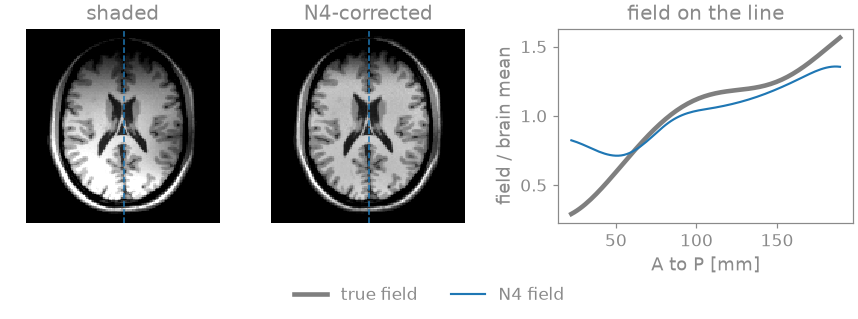 shaded, N4-corrected, field on the line
