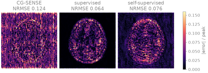 CG-SENSE NRMSE 0.124, supervised NRMSE 0.064, self-supervised NRMSE 0.076