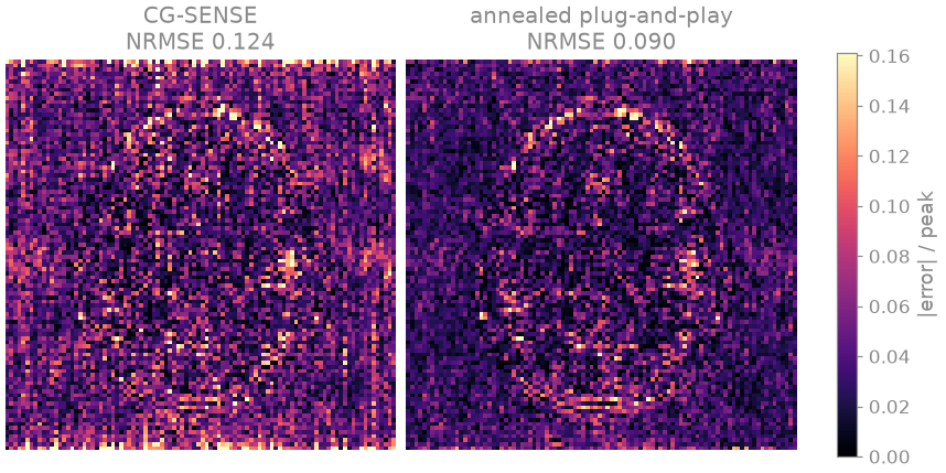 CG-SENSE NRMSE 0.124, annealed plug-and-play NRMSE 0.090
