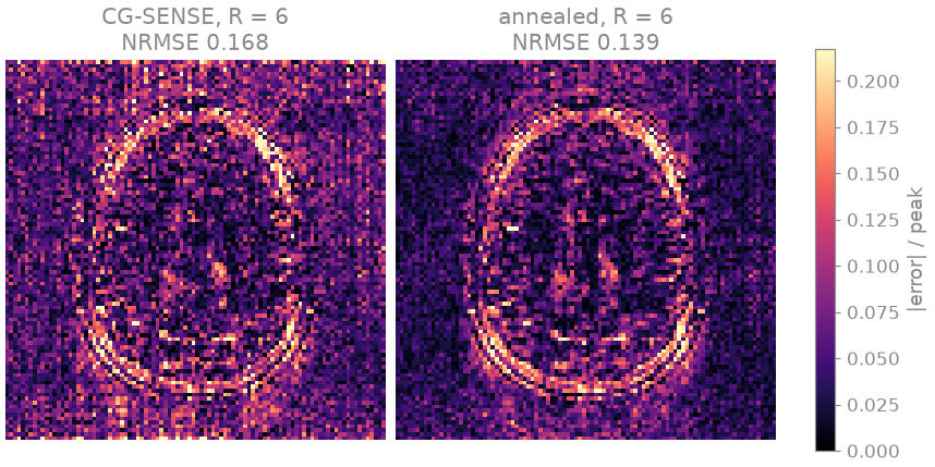 CG-SENSE, R = 6 NRMSE 0.168, annealed, R = 6 NRMSE 0.139