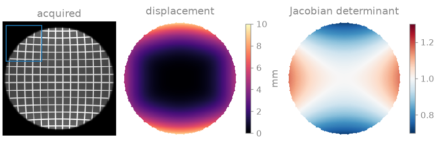 acquired, displacement, Jacobian determinant