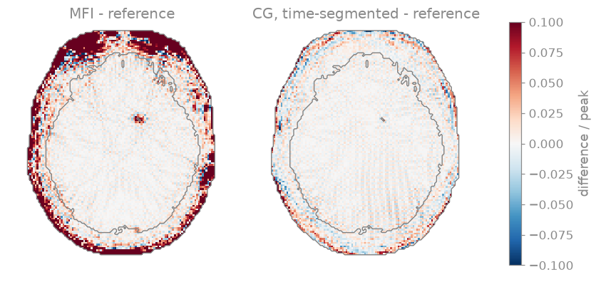 MFI - reference, CG, time-segmented - reference