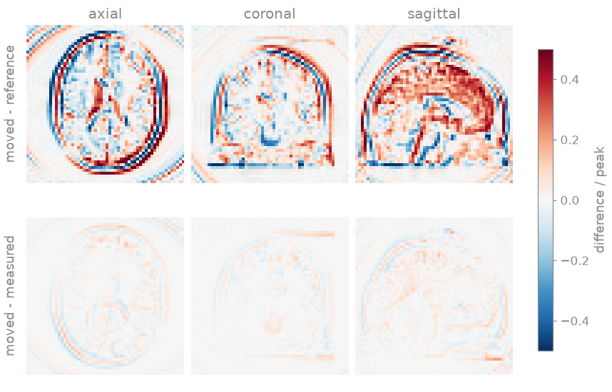 axial, coronal, sagittal