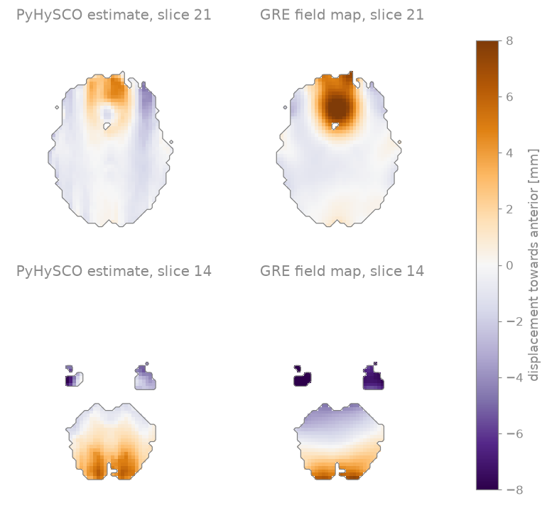 PyHySCO estimate, slice 21, GRE field map, slice 21, PyHySCO estimate, slice 14, GRE field map, slice 14