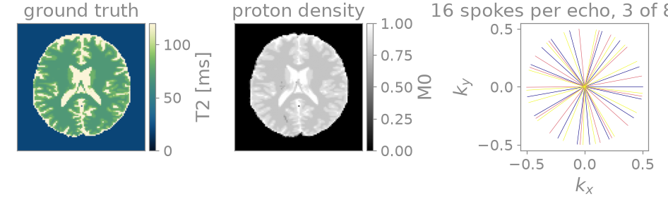 ground truth, proton density, 16 spokes per echo, 3 of 8 shown