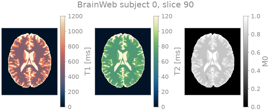 BrainWeb subject 0, slice 90